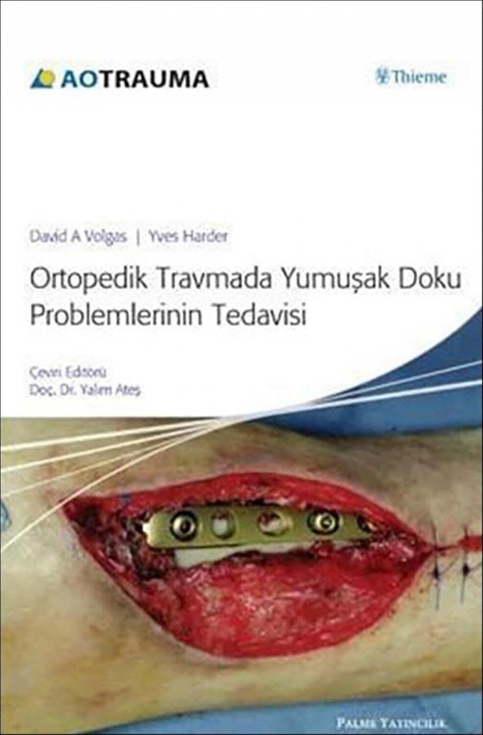 Ortopedik Travmada Yumuşak Doku Problemlerinin Tedavisi (Ciltli)